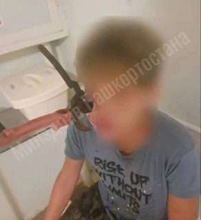 14-летний подросток получил травму лица во время игры в Башкирии